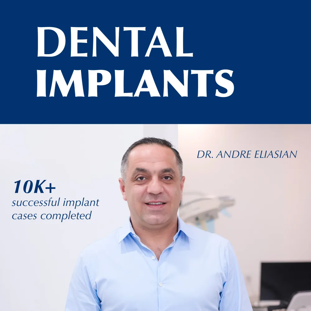 Elite Dental Group ChatGPT ad — Full Mouth Dental Implants in LA